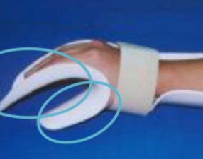 <p>Name this static splint component. What’s its function?</p>