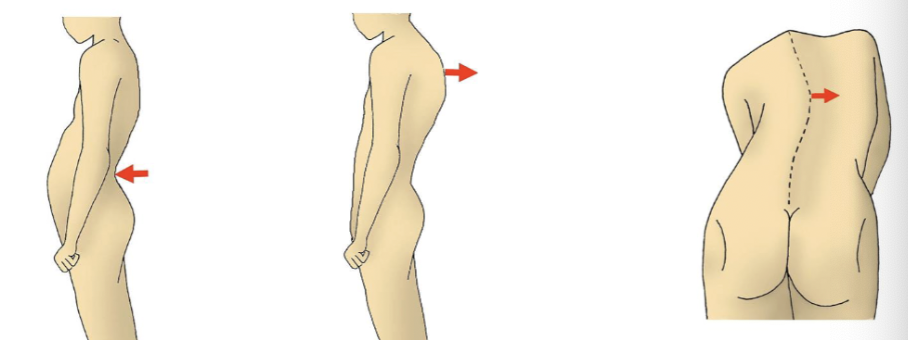 <p>vertebral column curvatures </p>