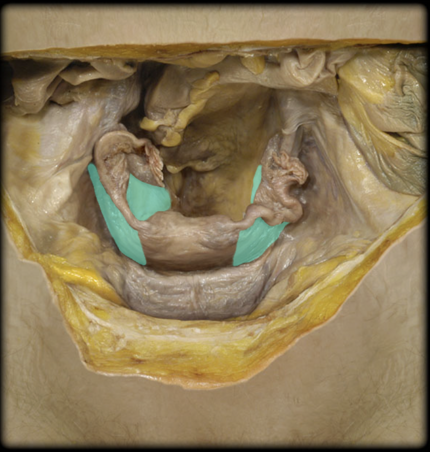 <p>What structure is shown?</p>