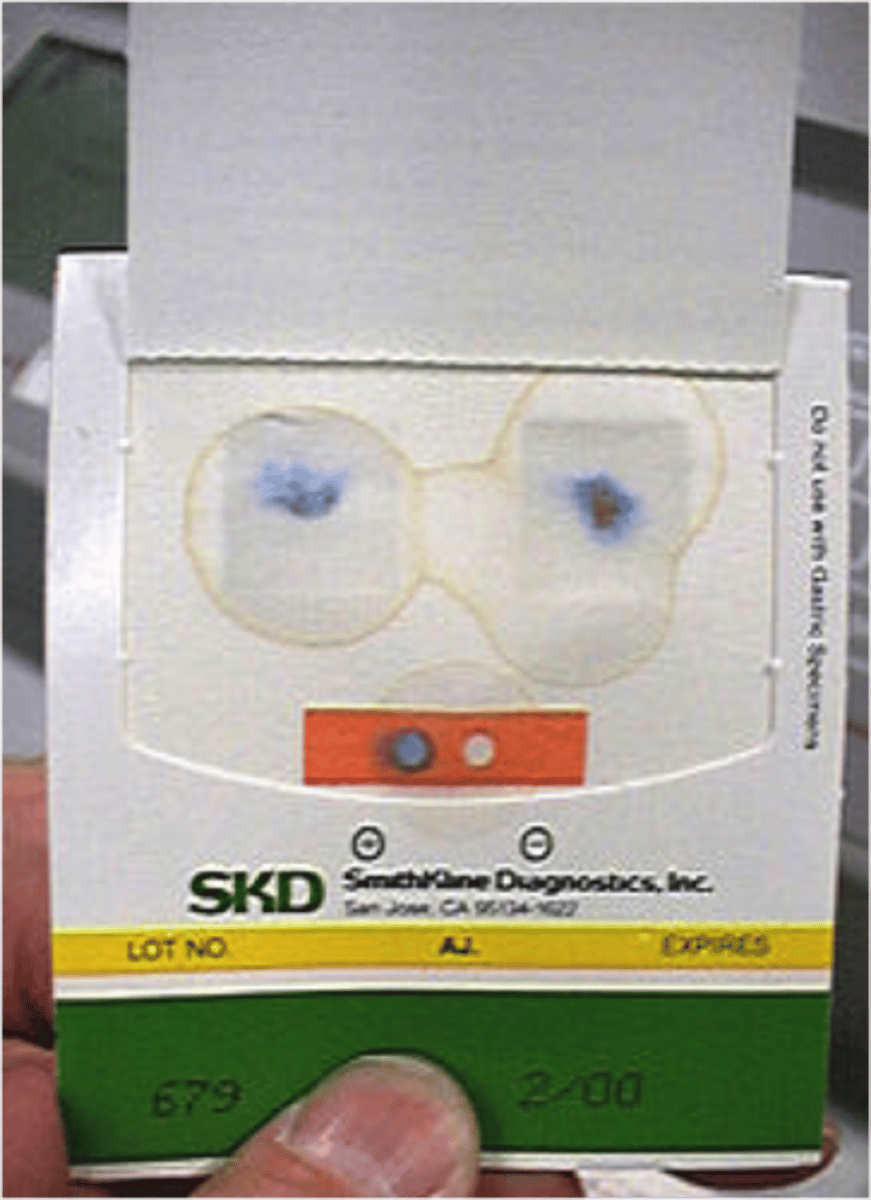 <p>need clean stool sample, test for blood in feces</p><p>blue means blood is present</p>