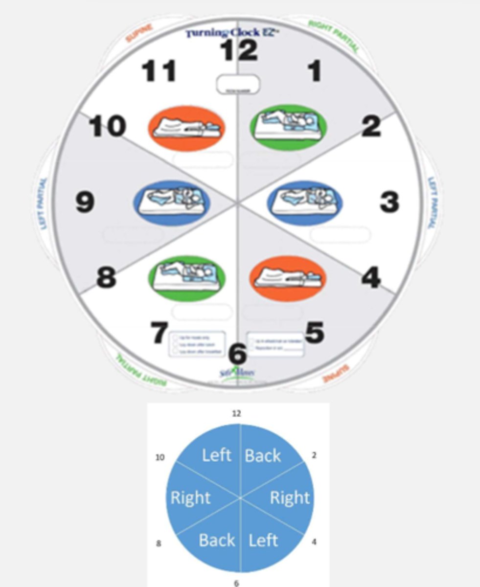 <p>PRESSURE REDISTRIBUTION</p><p>- every 2 hrs, 30 degree angles</p><p>- adequate hydration and nutrition</p><p>- keep bony prominences apart and off support surfaces</p><p>- pressure reducing support surfaces</p>