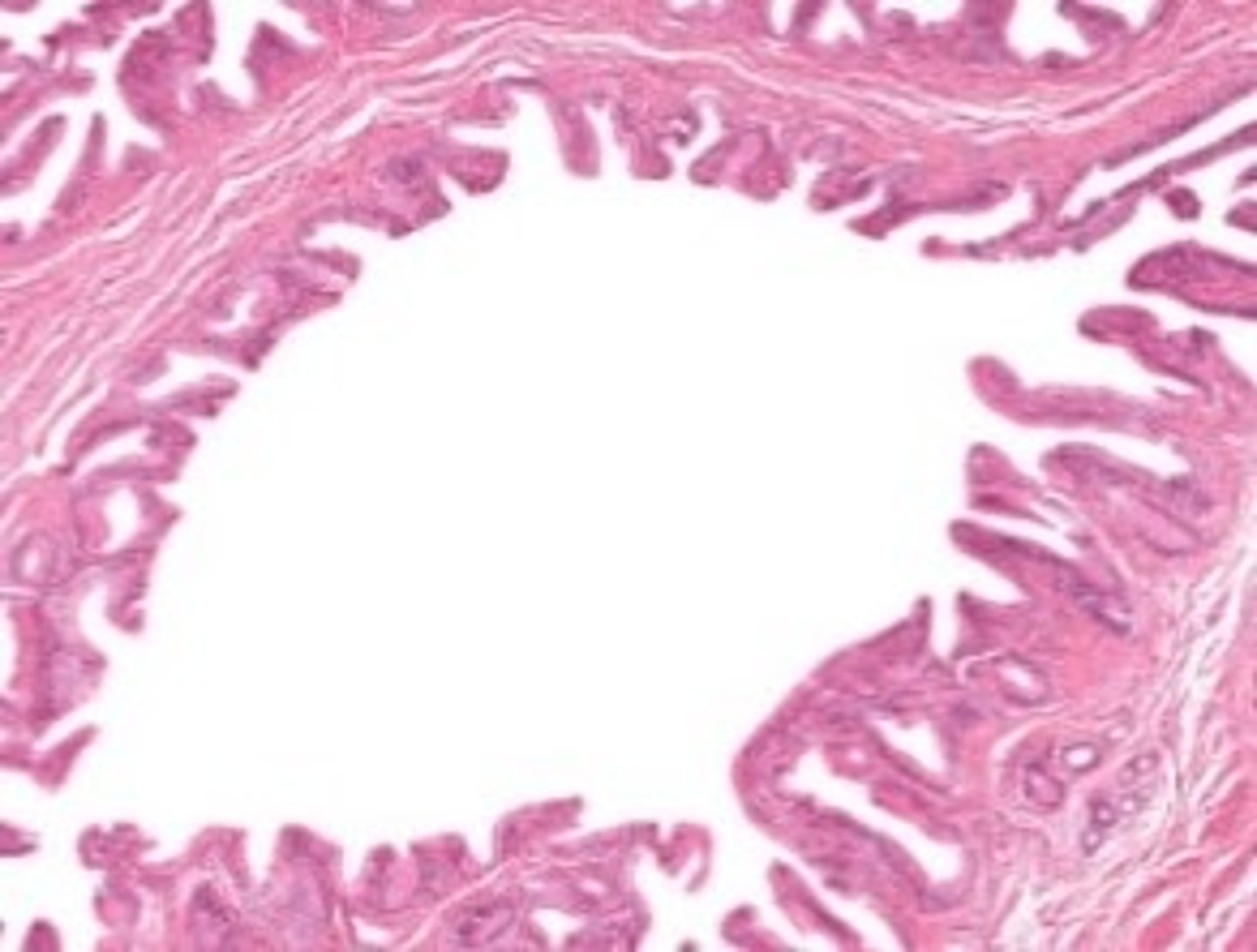<p>The lumen of bile duct</p>