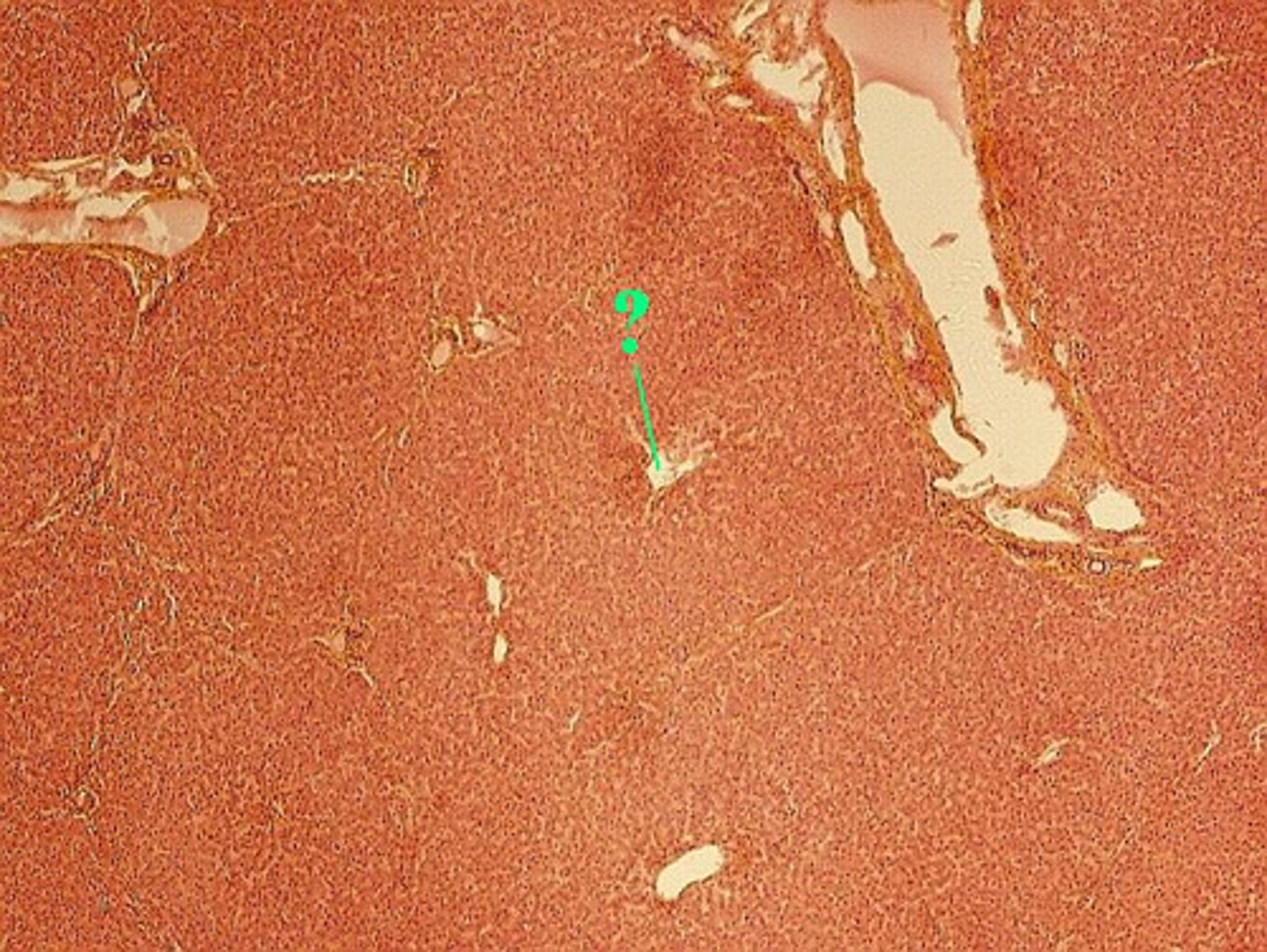 <p>Identify the indicated structure in the liver</p>