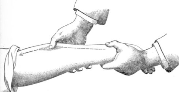 <p>Effleurage Massage </p>