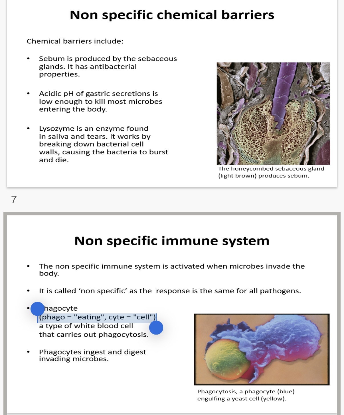 <p>Non specific chemical barriers:</p><p>Chemical barriers include:</p><p>• …1? is produced by the sebaceous glands and has …2? properties.</p><p>• …3? pH of gastric secretions is low enough to …4? most microbes entering the body.</p><p>• …5? is an enzyme found in saliva and tears. It works by …6? down bacterial cell …7?, causing the bacteria to burst and die</p><p></p><p>Non specific immune system :</p><p>• The non specific immune system is activated when microbes …8?</p><p>• It is called 'non specific' as the response is the …9? for all pathogens.</p><p>• Phagocyte(phago = "eating", cyte = "cell") is a type of …10? that carries out phagocytosis.</p><p>• Phagocytes …11? and digest invading microbes</p>
