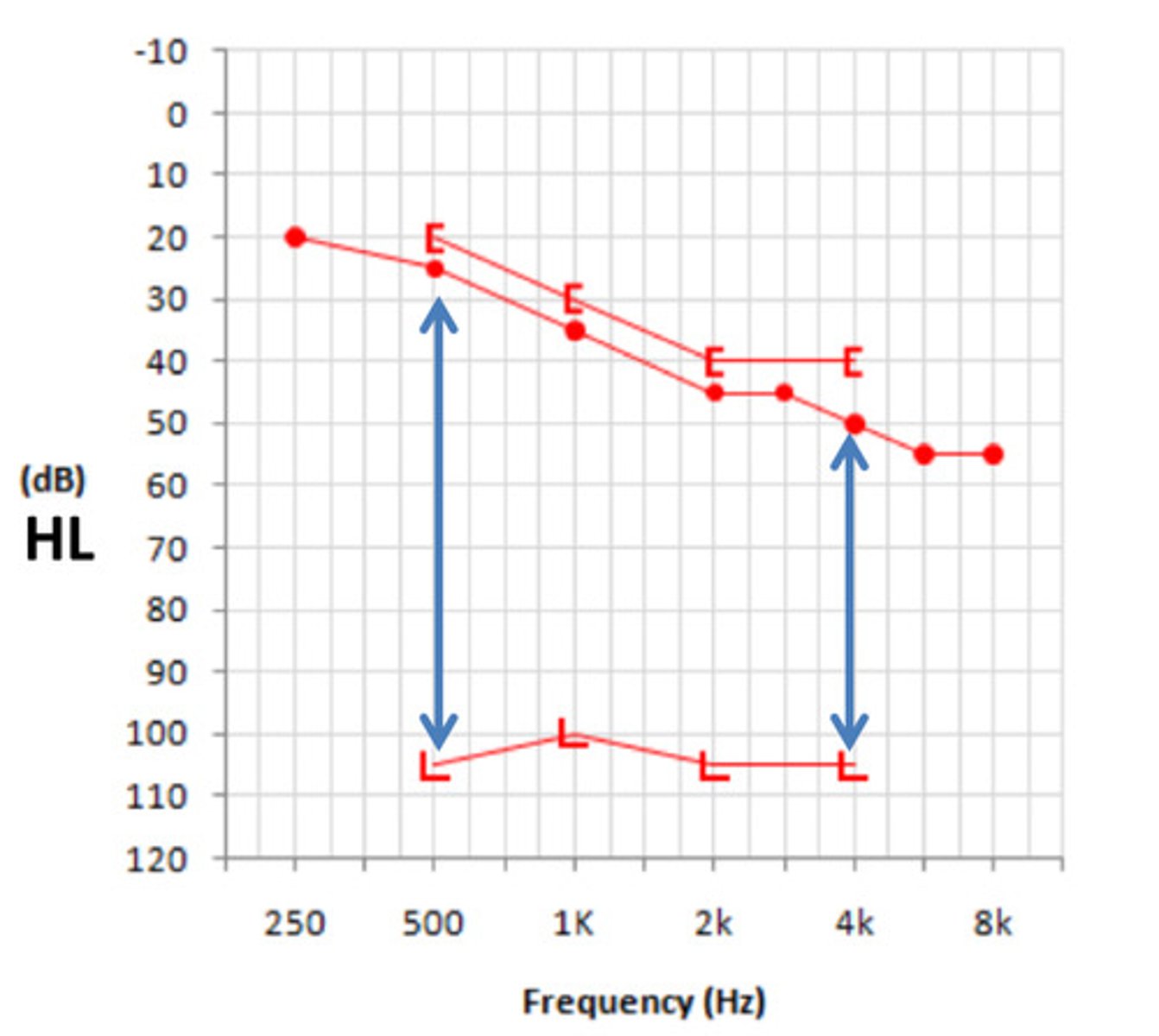 <p>5-105 dbhl</p>