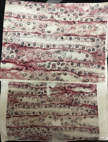 <p>What kind of tissue/cartilage is this? </p>