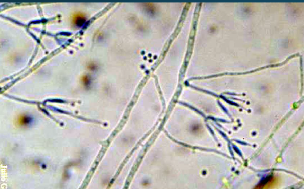 <p>An eye fungal culture was submitted on a patient and a fungus grew within 3 days. The colony morphology of the organism was white with a light yellow reverse and the lactophenol stain is pictured below. Based on this information, what is the identity of this organism?</p>