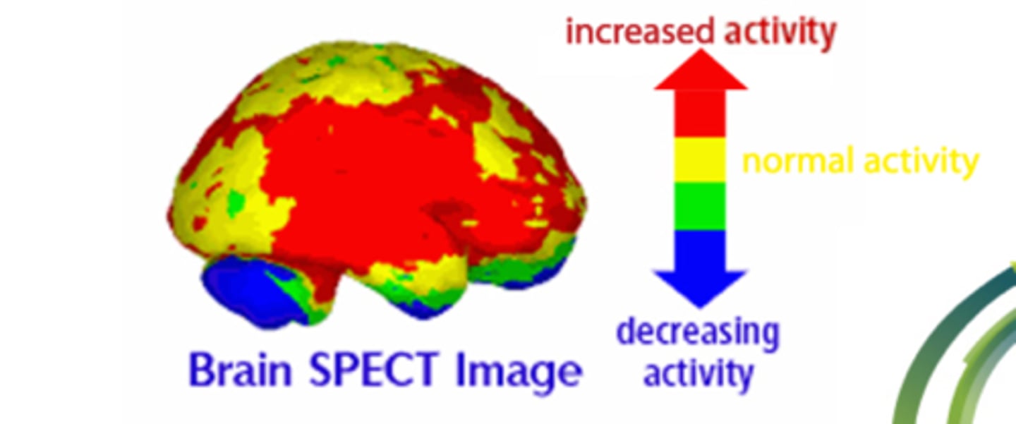 <p>-Single-photon emission computed tomography</p><p>-IV injection of radioactive tracer (gamma rays)</p><p>-Computer reconstruction of 3D images</p><p>-Detects liver tumors, cardiac ischemia, diseases on bone and spine</p>