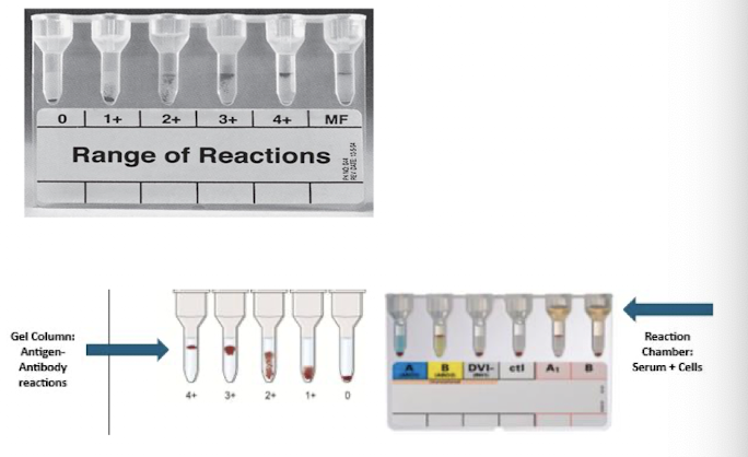 <p>Dextran acrylamide gel traps agglutinated cells.</p><ul><li><p>Gel particles + reagents predispensed in microtubes.</p></li><li><p>Add RBCs/plasma/serum, incubate, centrifuge.</p></li><li><p>Agglutinates trapped at top (4+), nonagglutinated cells at bottom (0).</p></li></ul><p></p>