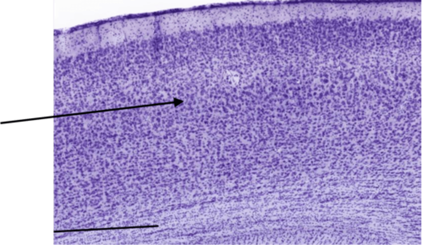<p>Identify the layer of the cerebrum</p>