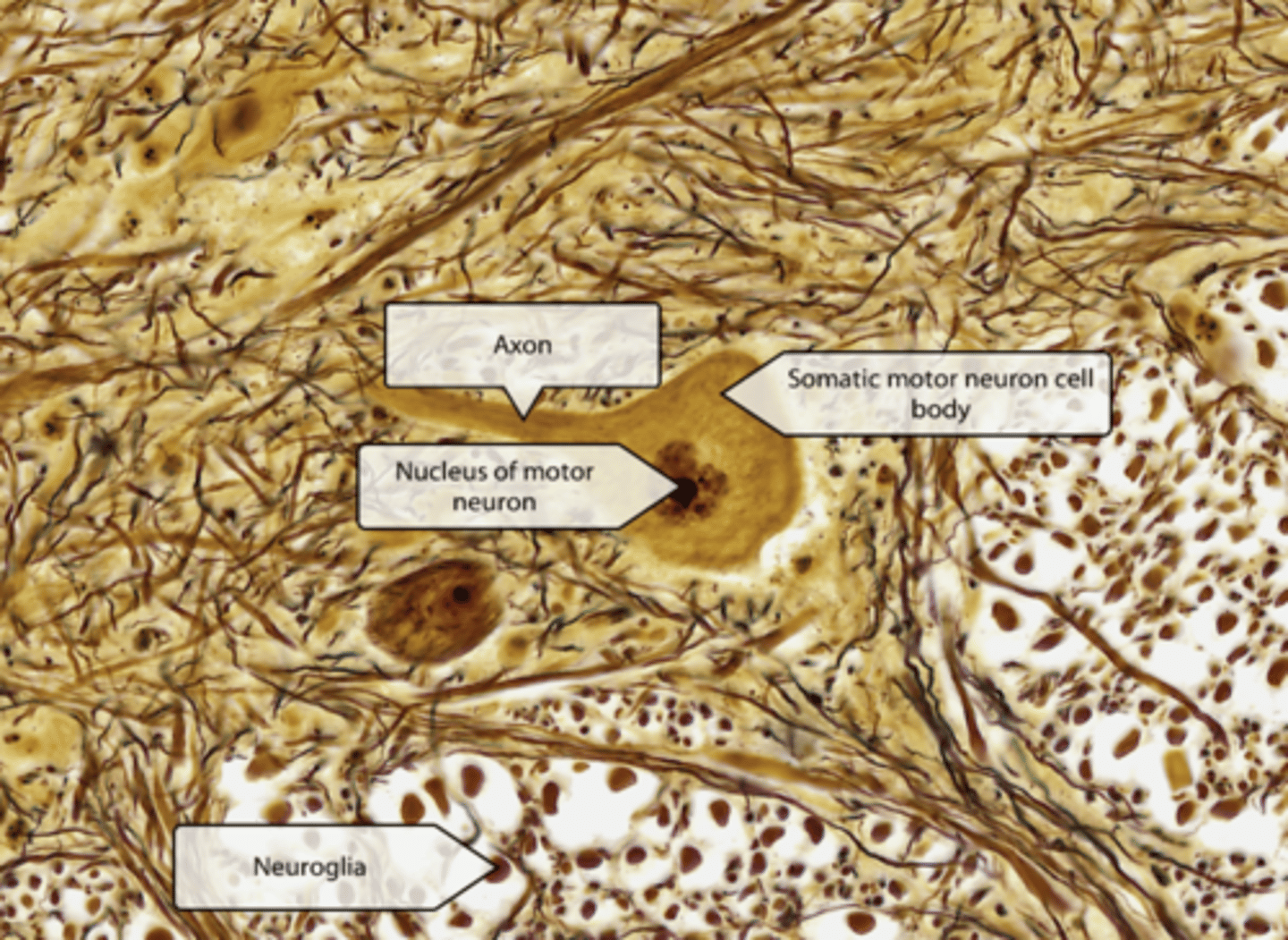 <p>Histology of gray matter: anterior horn</p><p>Gray matter horns composed of neuronal cell bodies, dendrites, unmyelinated axons, and neuroglia: form a centrally located H-shaped area in spinal cord. </p><p>Posterior horns contain interneurons and sensory relay neurons that receive sensory input from axons conveying touch, temp, pain, and proprioceptive info from body. </p><p>Anterior horns contain somatic motor neuron cell bodies that facilitate movement. </p><p>gray commissure connects these regions and surrounds the central canal: the (CFS) cerebrospinal fluid-filled space that runs down the center of the spinal cord.</p><p>Lateral horns are present ONLY in thoracic and superior lumbar spinal cord segments and contain autonomic motor neuron cell bodies that intervene in the visceral organs </p>