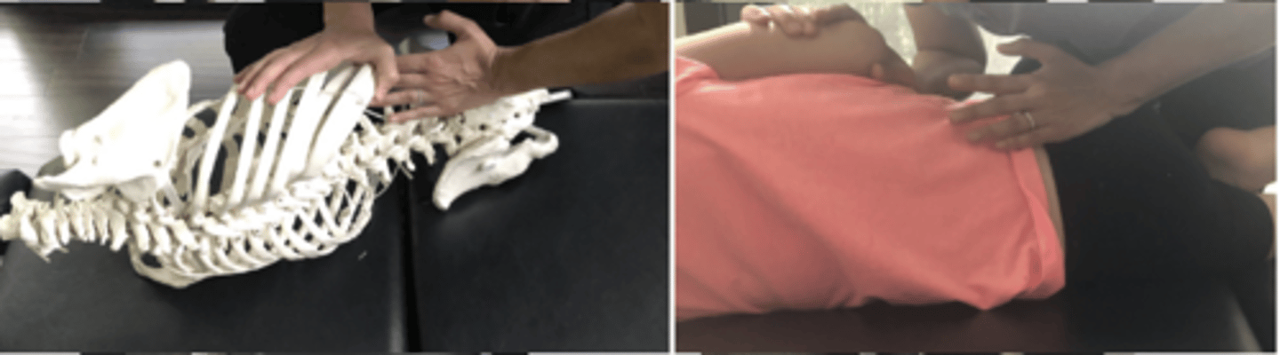 <p>PP: Basic side posture position with the dysfunctional side up-verbalize how you found the segment</p><p>DP: Modified fencer stance on side of dysfunction</p><p>CH: Caudal (L) hand, hypothenar (pisiform) on R sacral base (just medial to R PSIS)</p><p>IH: Cephalic (R) hand slight upward traction holding the pt's up-side shoulder or overlapping hand</p><p>LOD: P-A, slight I-S</p>