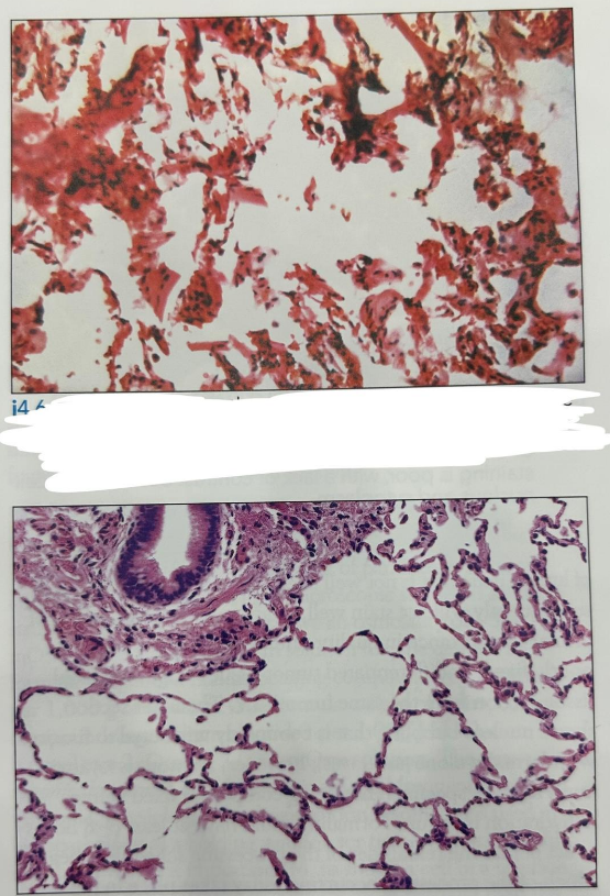 <p>What’s the difference between these two samples?</p>
