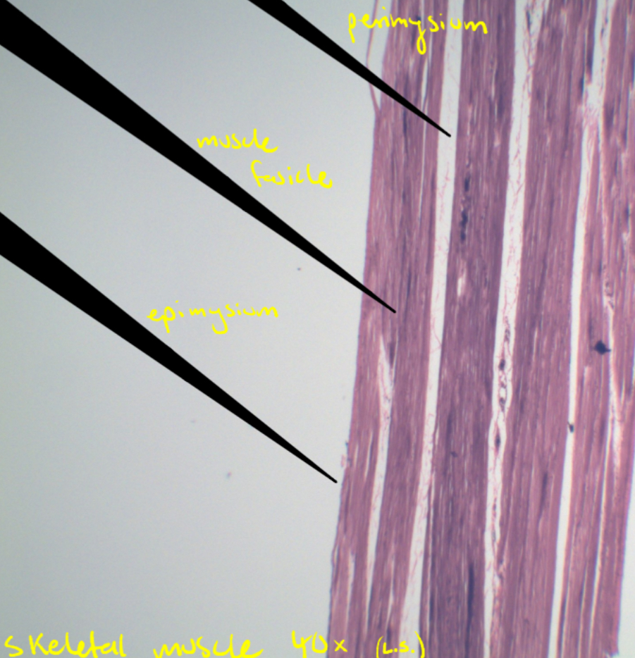<p>Epimysium</p>