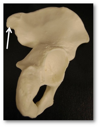 Name this specific part of the pelvic bone.