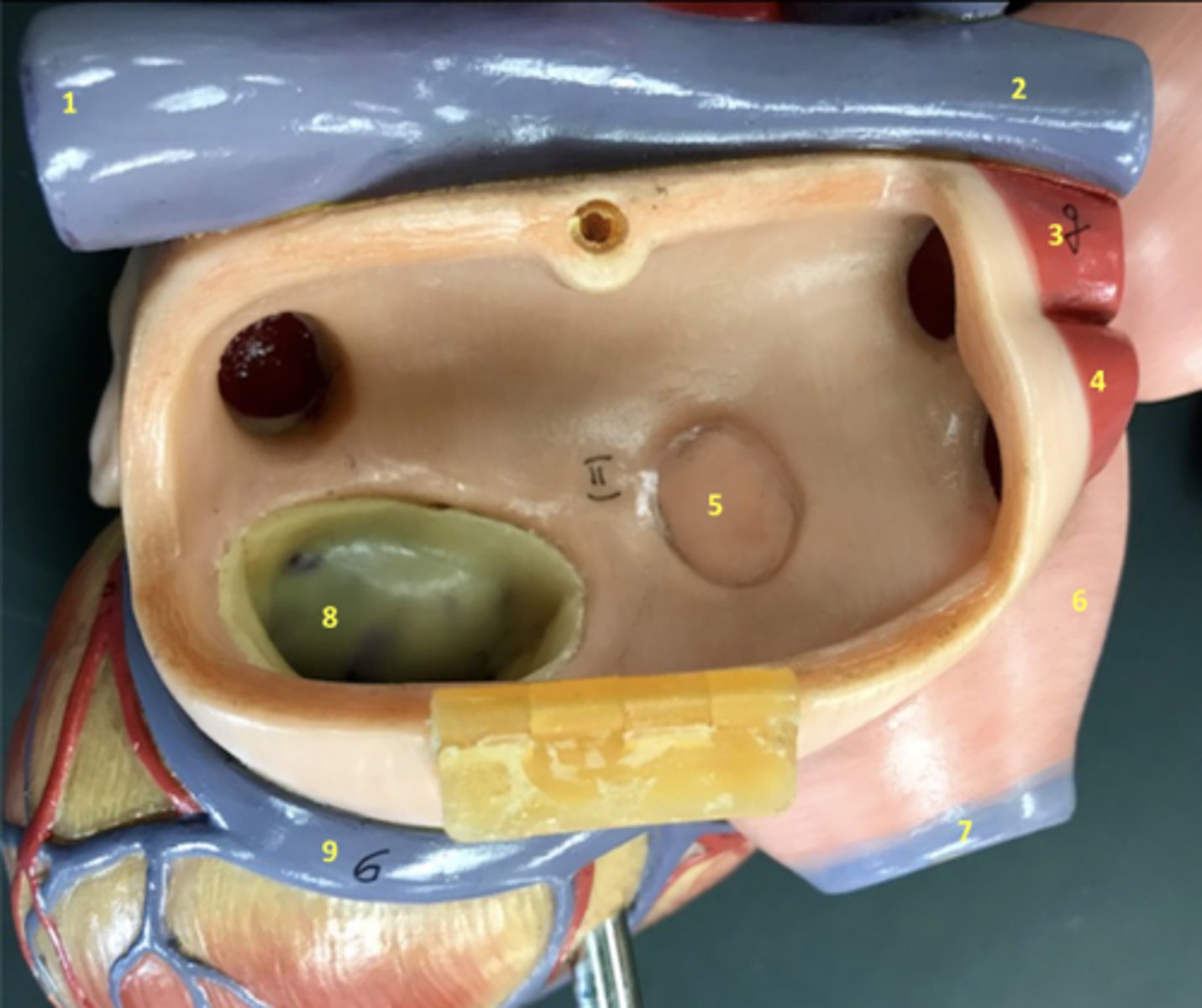 <p>What is 5?</p>