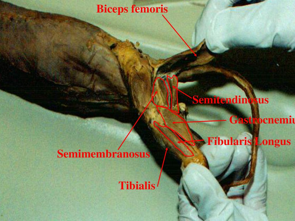 <p>Origin: Lateral Aspect of the head of the fibula</p><p>Insertion: Bases of the metatarsals and digits</p><p>Action: Extends the foot and flexes the digits</p>