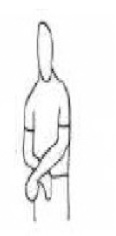 <p>Shoulder EXT, ADD, IR </p><p>Forearm - Pro </p><p>Wrist - Ulnar ext. </p><p>Fingers - flexion</p>