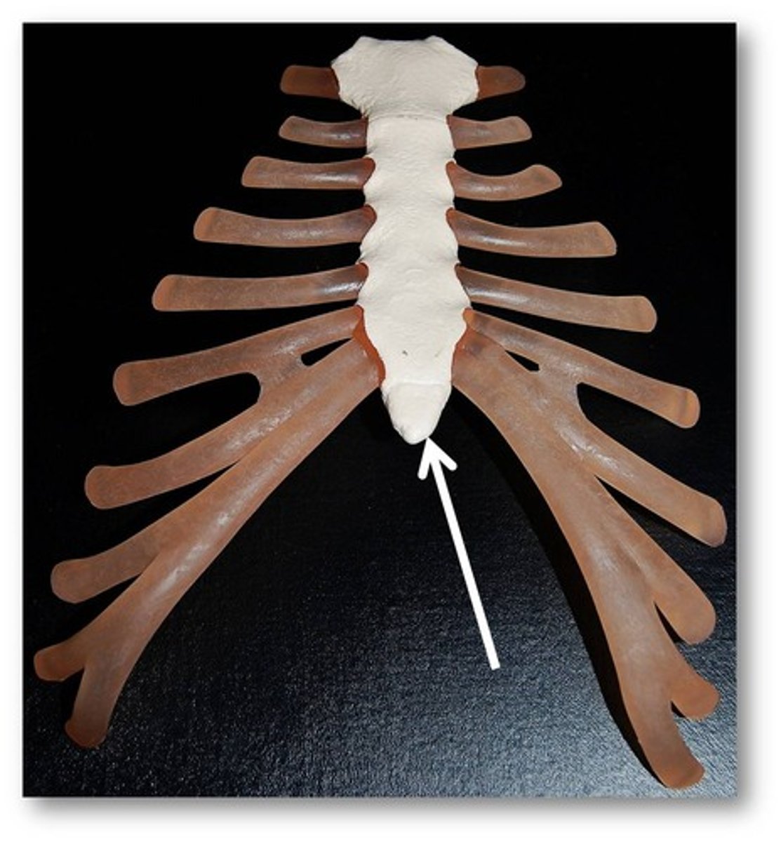 <p>Sternum - inferior tip</p>