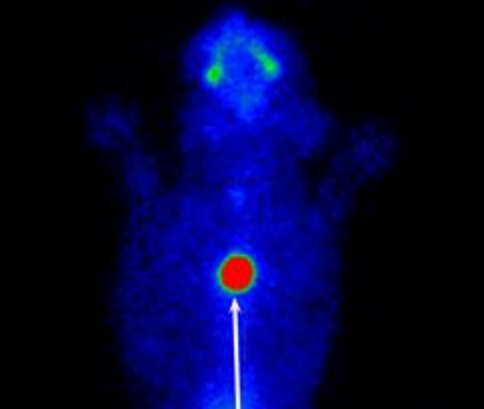 <p>describe the scintingraphy </p>