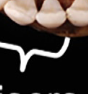 <p>incisors </p>
