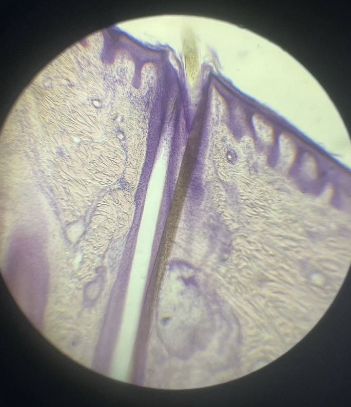 <p>Шкіра з волоссям </p>