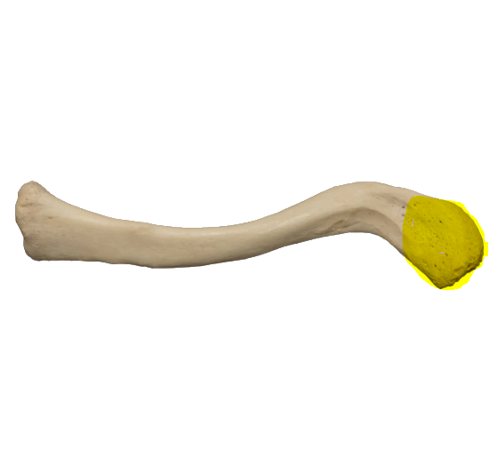 <p>What end of the clavicle is this?</p>