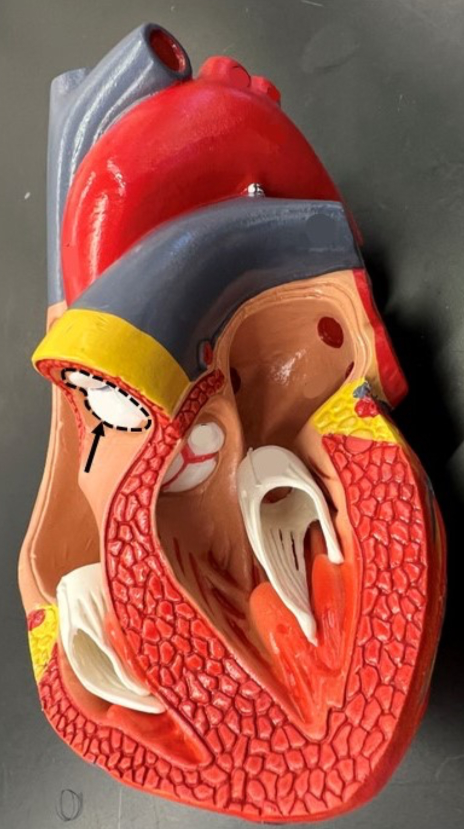 term image