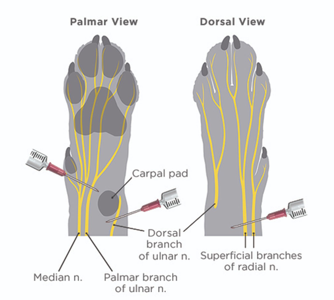 <p>- At fast sodium channels</p>