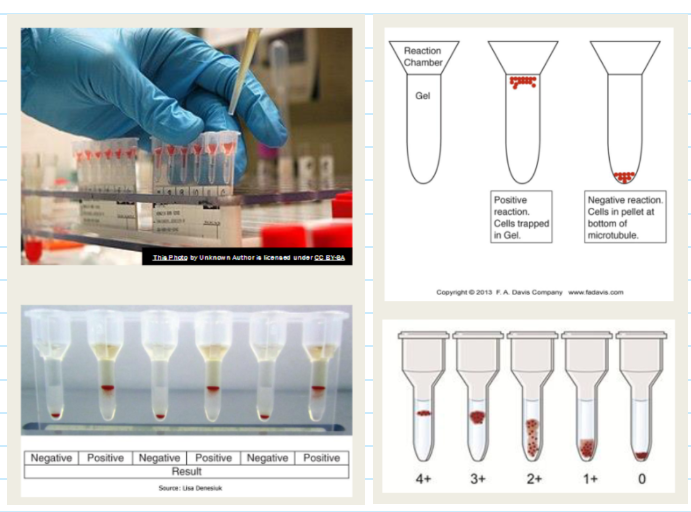 <ul><li><p><span>Agglutination visualized by capture of RBCs within gel column</span></p></li><li><p><span>Used for same routine tests as tube testing</span></p></li><li><p><span>involves microtubules filled with a dextran acrylamide gel</span></p></li><li><p><span>The screen cells used for this technique meet the same criteria as for the tube test BUT are suspended in LISS to a concentration of 0.8%</span></p></li><li><p><span><u>Large agglutinates remain near or on top of the gel matrix</u></span></p></li><li><p><span><u>Smaller agglutinates pass through the gel matrix</u></span></p></li><li><p><span><u>Unagglutinated cells pass through the gel matrix to form a button at the bottom of the microtubules</u></span></p></li></ul><p></p>