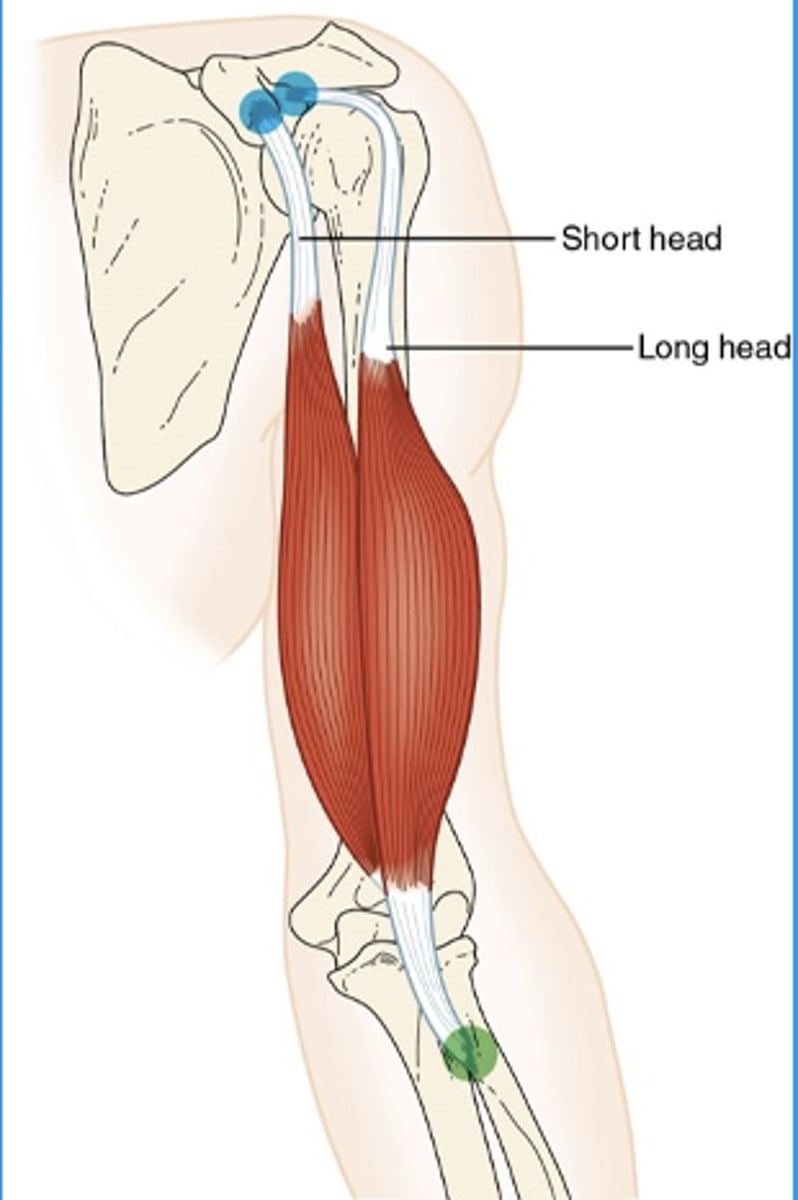 <p>What muscle is this?</p>