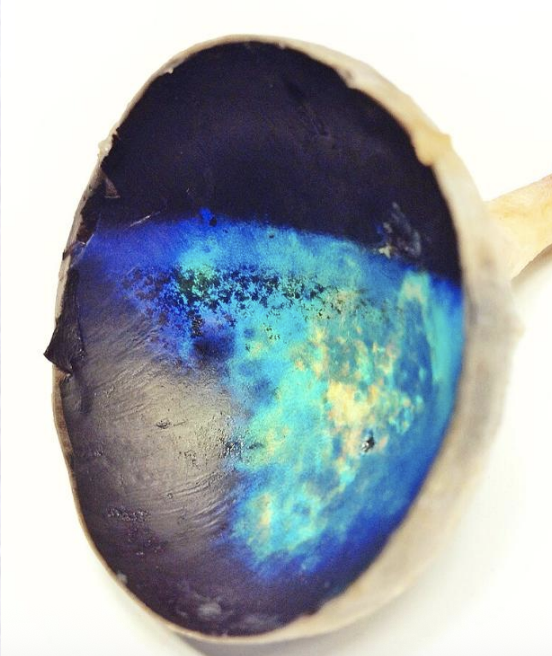 <p>What structure/layer, found in the dorsal choroid, is shown in the image and is not seen in pigs?</p>