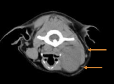 <p><35% - lungs</p><p><10% - lymph nodes</p><p>70% tonsillar SC </p>