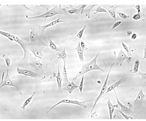 <p>small, spindle-shaped cells with large nuclei, prominent nucleoli, and fine chromatin</p>