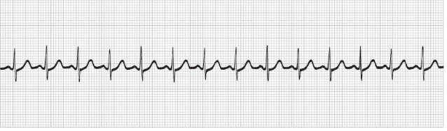 <p>what rhythm is this</p>