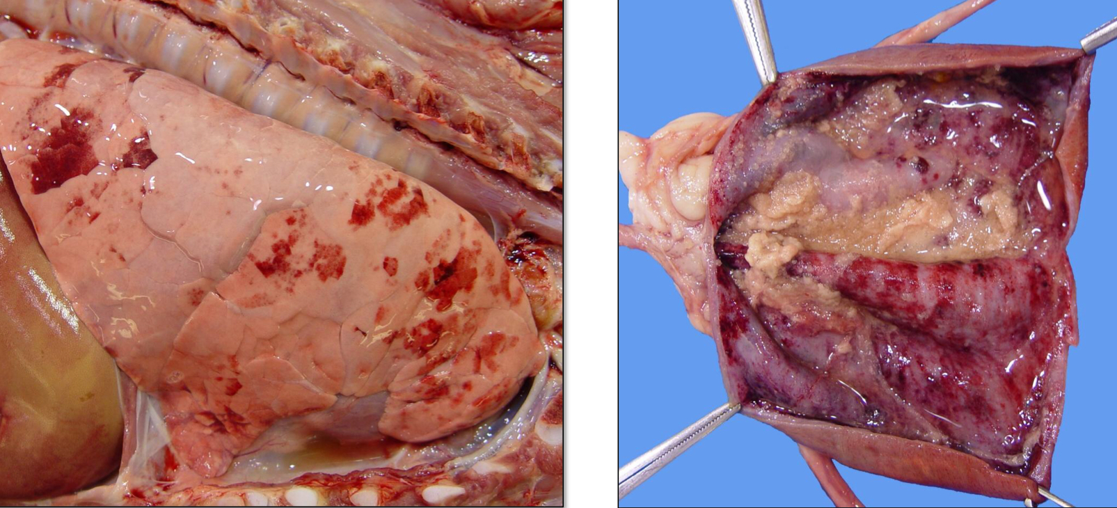 <p>What type of hemorrhage is this?</p>