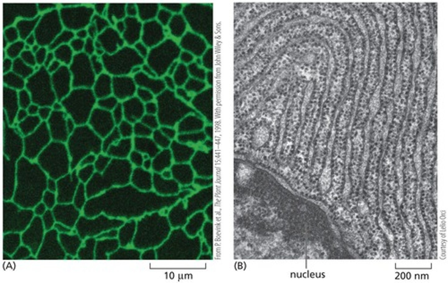 <p>A type of imaging that shows the endoplasmic reticulum as a complex network of tubes in a living plant cell.</p>