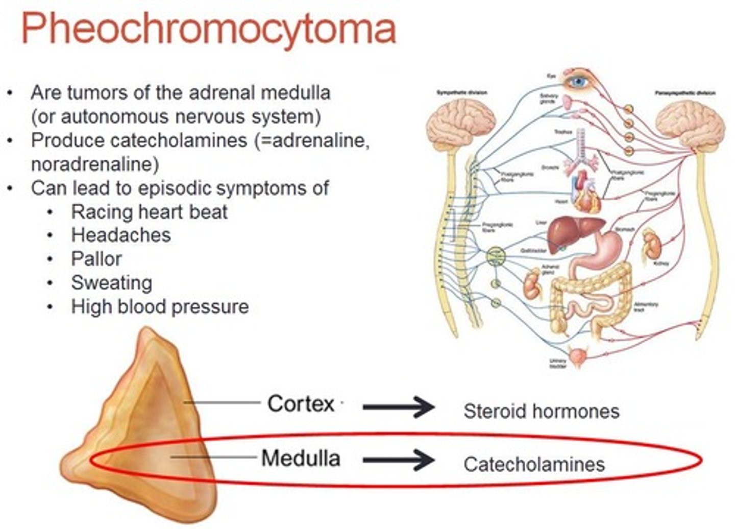 <p>hypersecretion of epi/norepi. persistent HTN, increased HR, hyperglycemia, diaphoresis, tremor, pounding HA; avoid stress, frequent bathing and rest breaks, avoid cold and stimulating foods (surgery to remove tumor)</p>