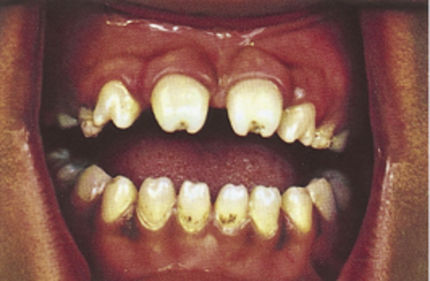 <p>Diagnosis?</p>
