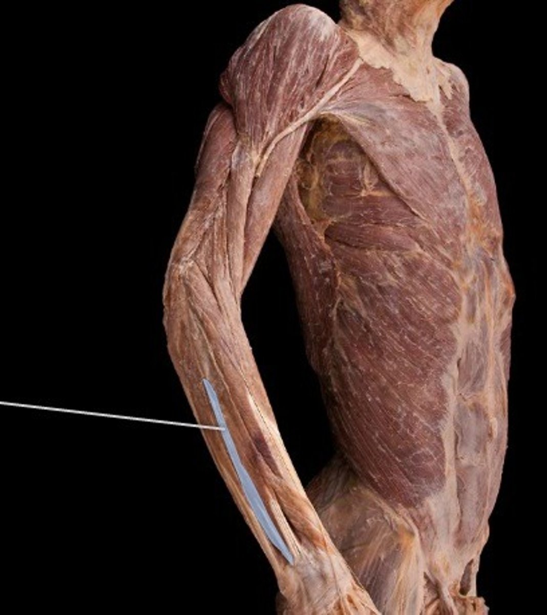 <p>What muscle is this?</p>