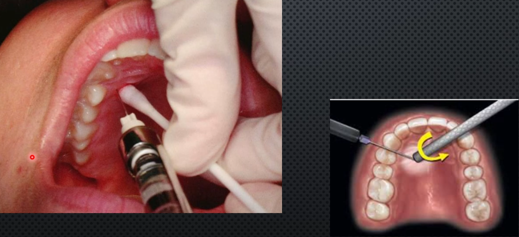 knowt flashcard image