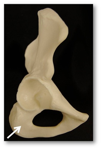 Name this specific region of the pelvic bone.
