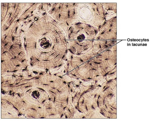 <p><strong>Picture example of bone tissue: </strong></p>