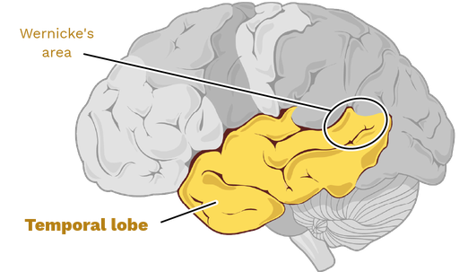 <ul><li><p>posterior part of superior temporal lobe </p></li><li><p>important for attaching meaning to sensory input </p></li><li><p>damage results in Wernicke’s aphasia</p><ul><li><p>receptive language impairment </p></li></ul></li></ul>