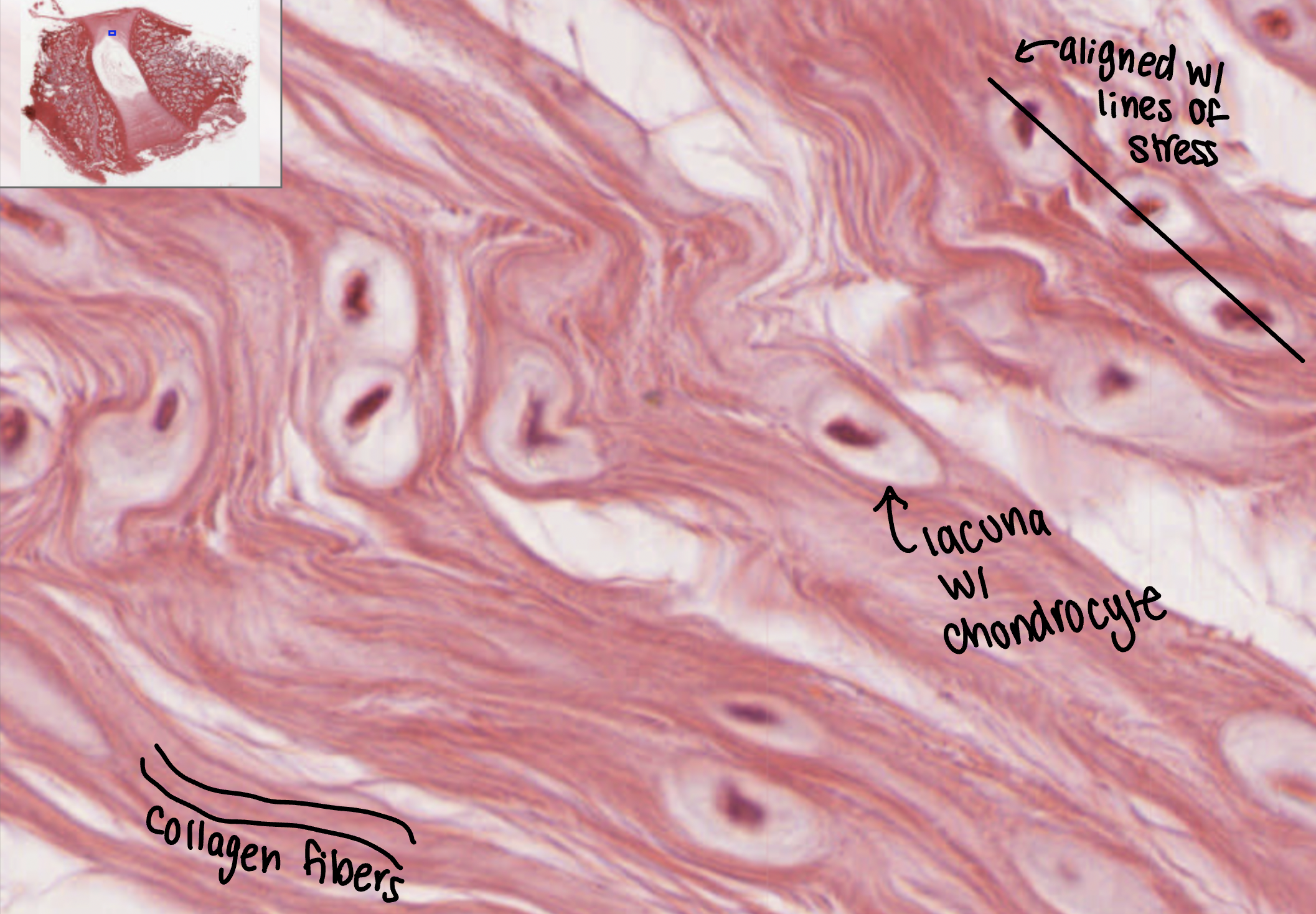 <p>menisci in the knee joint and the intervertebral discs</p>