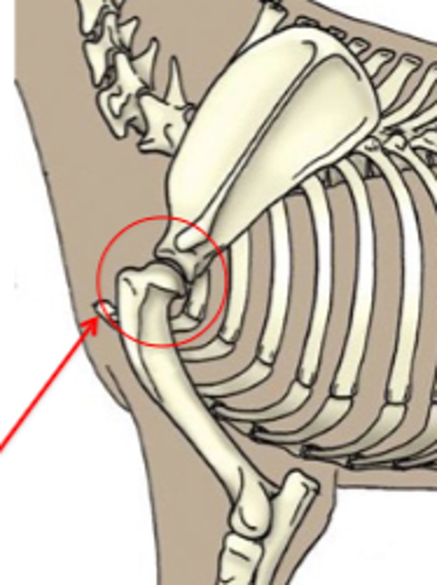 <p>The shoulder consists of what type of joint?</p>