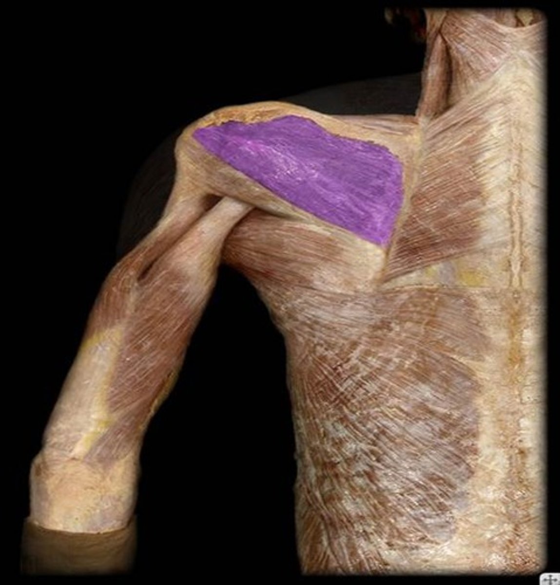 <p>What is the name of this muscle, highlighted in purple?</p>