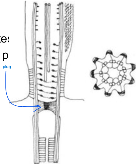 <ul><li><p>No basal plates</p></li><li><p>Has a plug</p></li></ul><p></p>