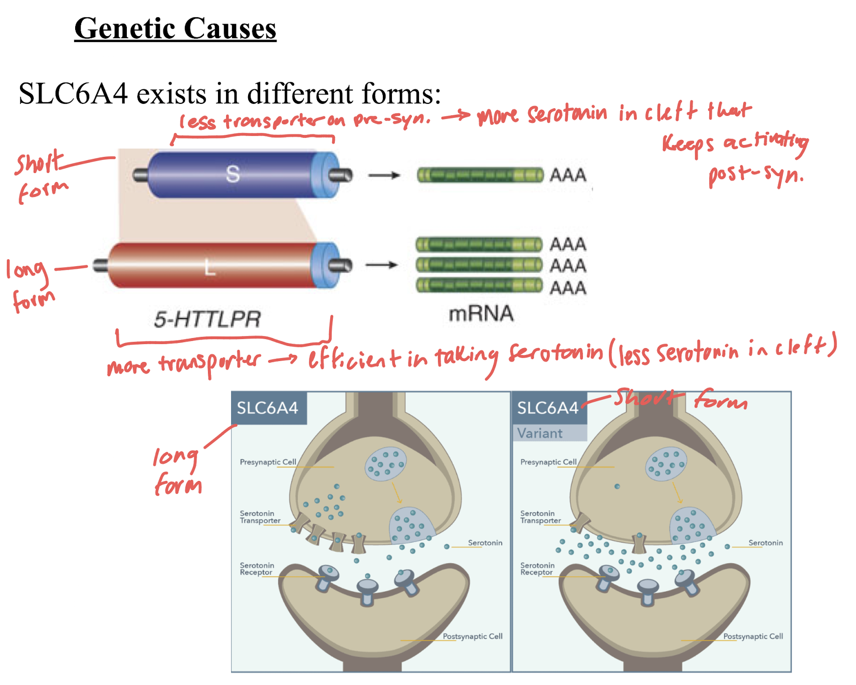 <ul><li><p>serotonin transporter allele:</p><ul><li><p>short: less transporter on pre-synap. → more serotonin in cleft → keeps activating post-synap. → incr risk of MDD</p></li><li><p>long: more transporter → efficient in taking serotonin → less serotonin in cleft</p></li></ul></li><li><p>overactivation of amygdala</p></li></ul><p></p>